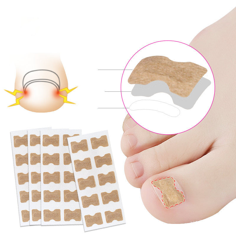 Glue-free orthopaedic nail fixation device - MAXIME