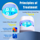 Maxime Nail Fungus Laser Treatment Device Repair Toenail Fingernail Fungus Treat Onychomycosis Therapy Cure Machine Effectively Remove - MAXIME