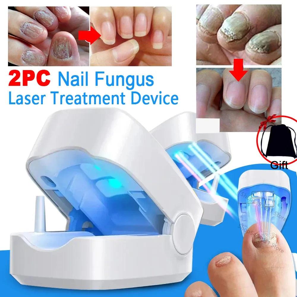 Maxime Nail Fungus Laser Treatment Device Repair Toenail Fingernail Fungus Treat Onychomycosis Therapy Cure Machine Effectively Remove - MAXIME