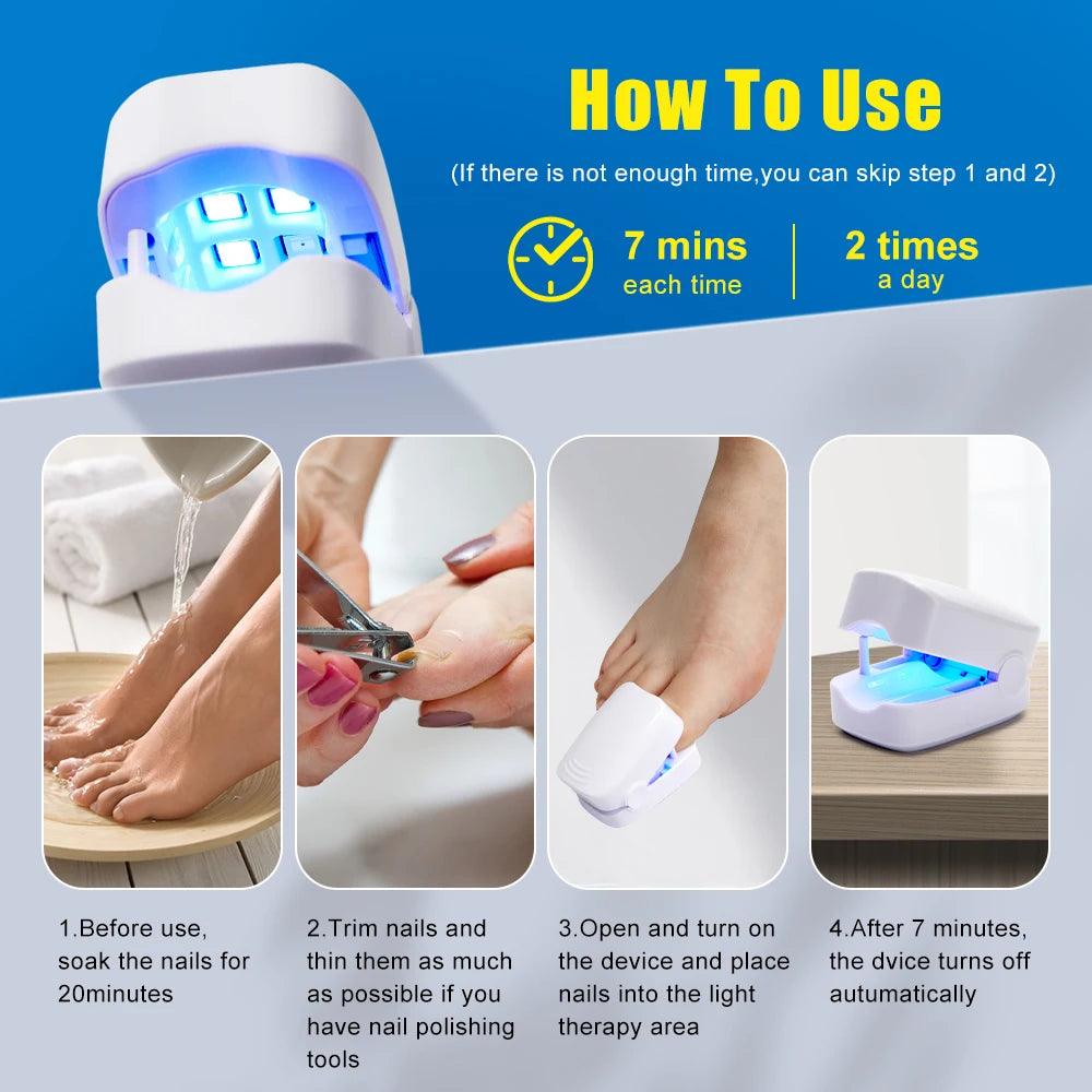 Maxime Nail Fungus Laser Treatment Device Repair Toenail Fingernail Fungus Treat Onychomycosis Therapy Cure Machine Effectively Remove - MAXIME